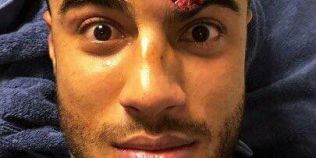 VIDEO Accidentare horror pentru un jucator de la Barcelona. Un coleg a reusit sa-i crape fruntea