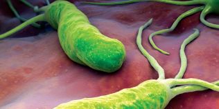 Ce nu stiai despre infectia cu Helicobacter pylori